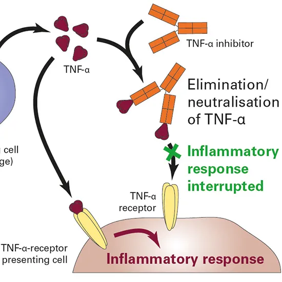 infliximab anti tnf blocker